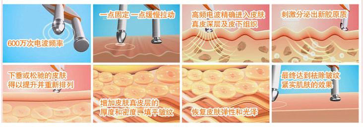 武汉电波拉皮除皱原理是怎样的