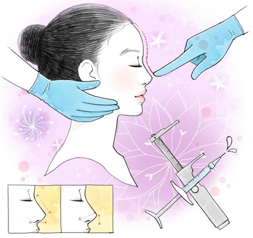 武汉什么时候适合做鼻头缩小