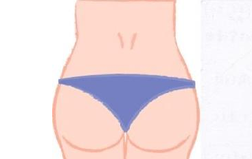 武汉自体丰臀手术有哪些步骤