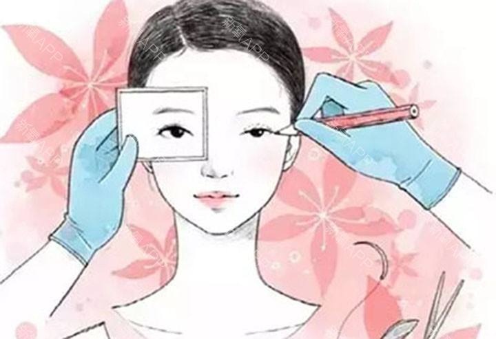 武汉怎么避免双眼皮术后留疤呢
