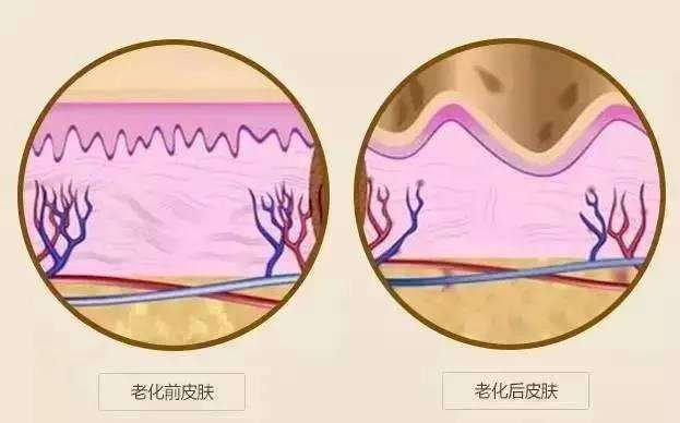 武汉做射频除皱疼不疼呢