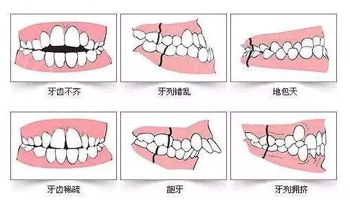 武汉牙齿矫正需要多久