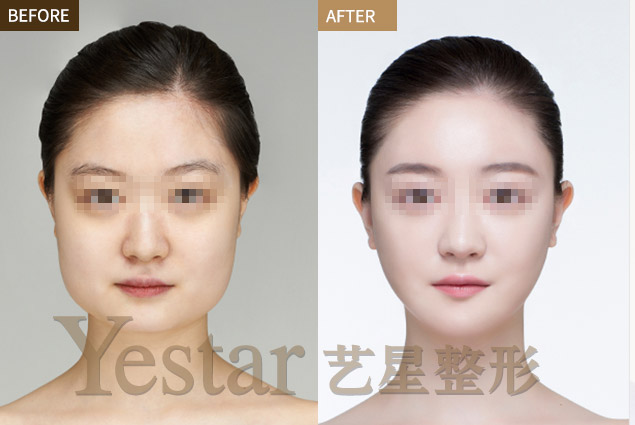 改脸型改变命运